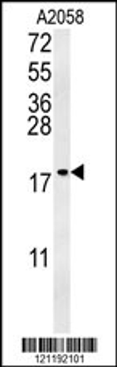Western blot analysis in A2058 cell line lysates (35ug/lane) .