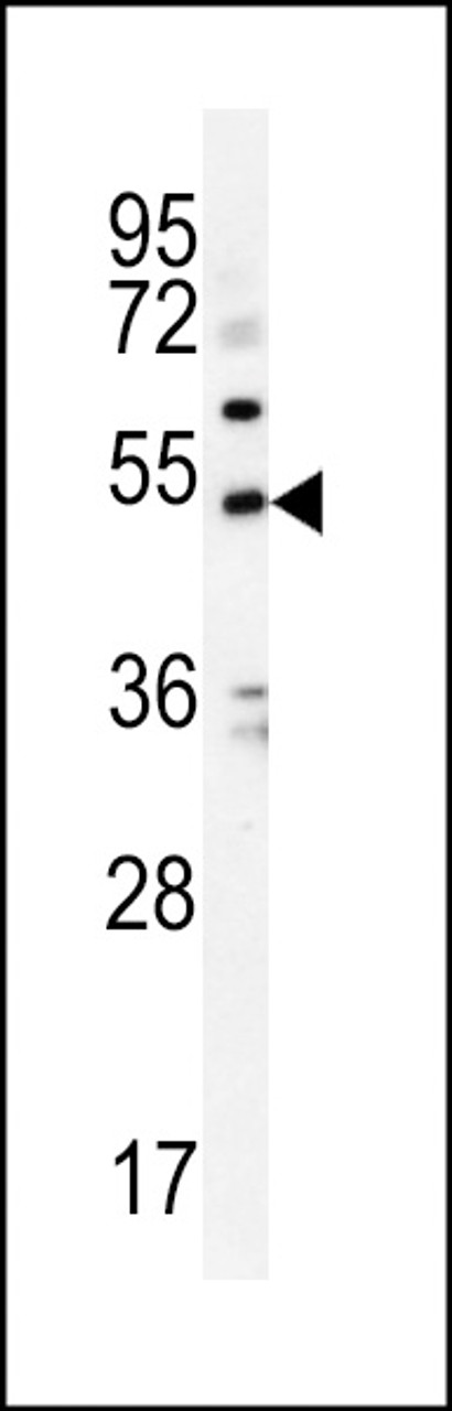 Western blot analysis in K562 cell line lysates (35ug/lane) .