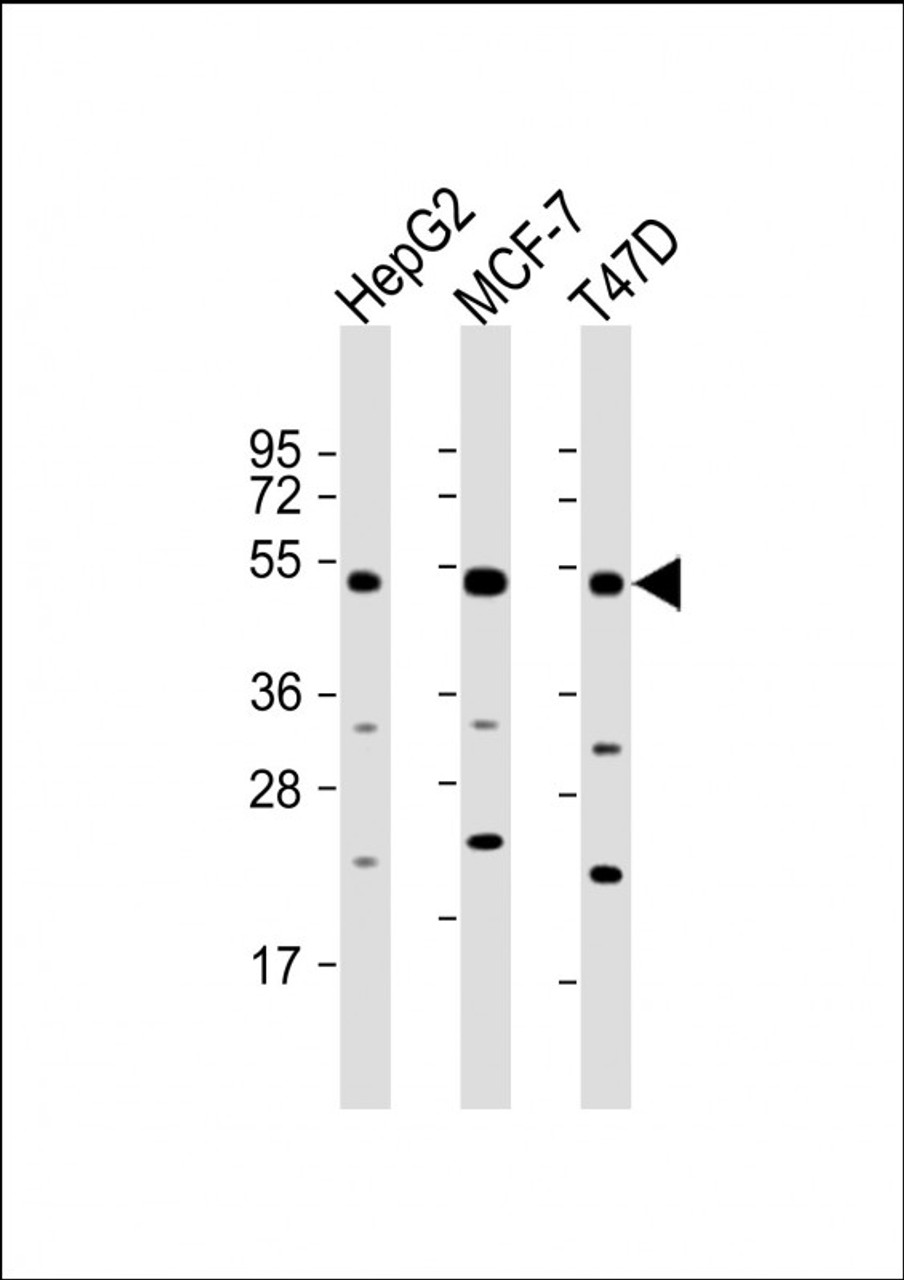 Western Blot at 1:2000 dilution Lane 1: HepG2 whole cell lysate Lane 2: MCF-7 whole cell lysate Lane 3: T47D whole cell lysate Lysates/proteins at 20 ug per lane.
