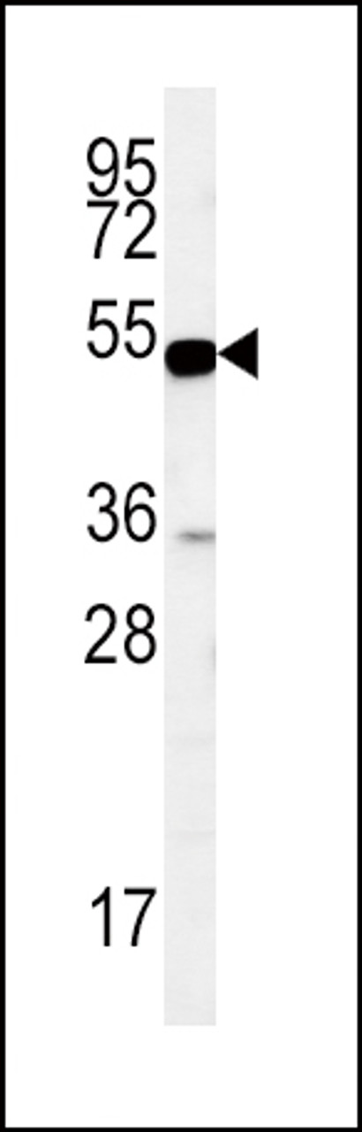 Western blot analysis in MDA-MB435 cell line lysates (35ug/lane) .