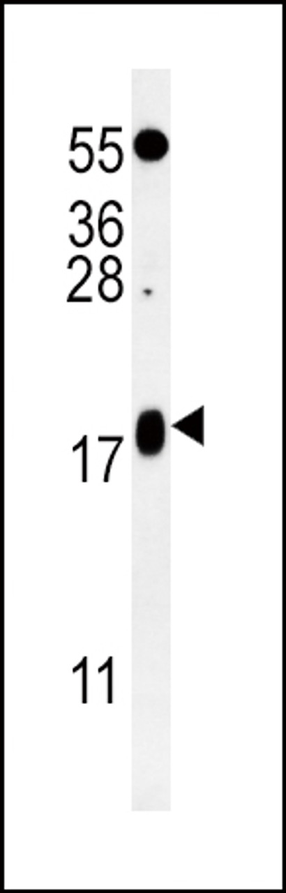 Western blot analysis in K562 cell line lysates (35ug/lane) .