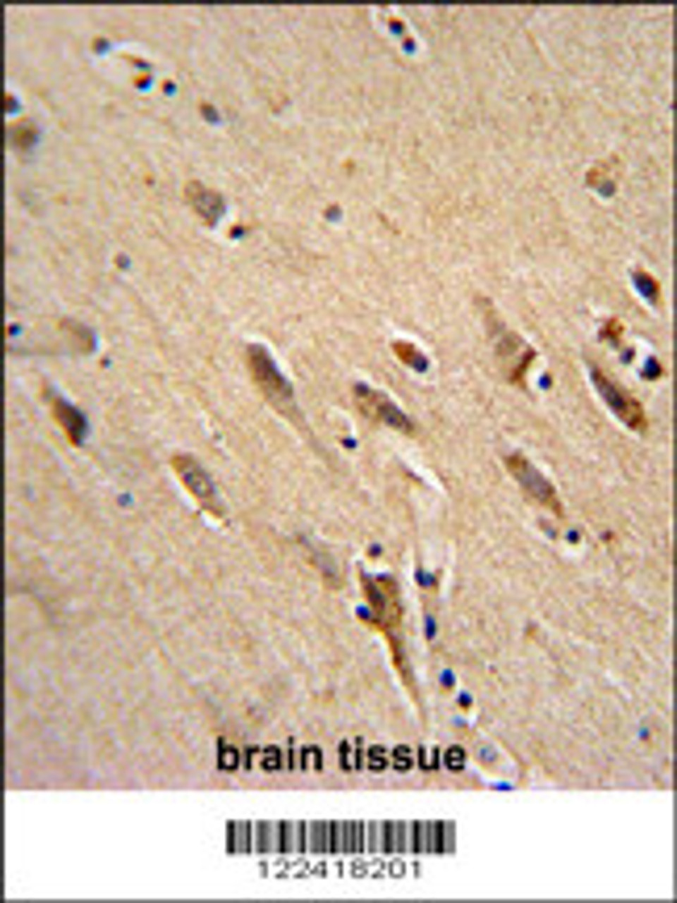 ARF1 Antibody immunohistochemistry analysis in formalin fixed and paraffin embedded human brain tissue followed by peroxidase conjugation of the secondary antibody and DAB staining.