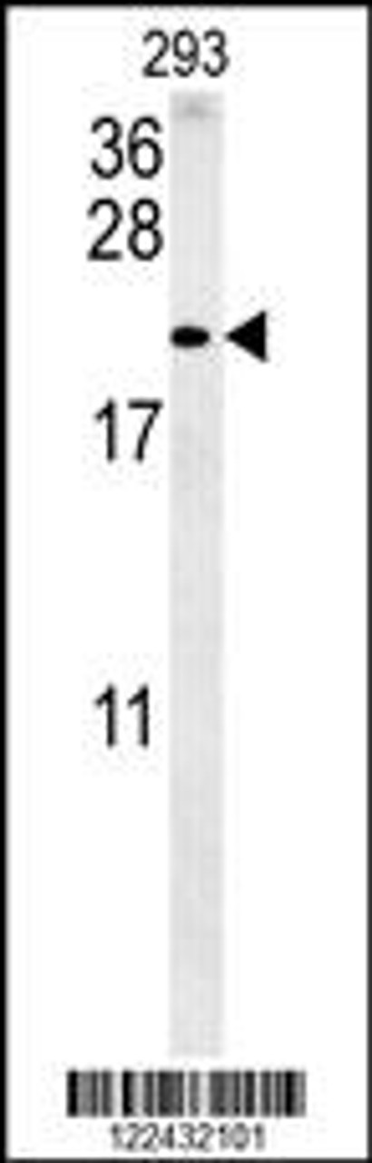 Western blot analysis in 293 cell line lysates (35ug/lane) .