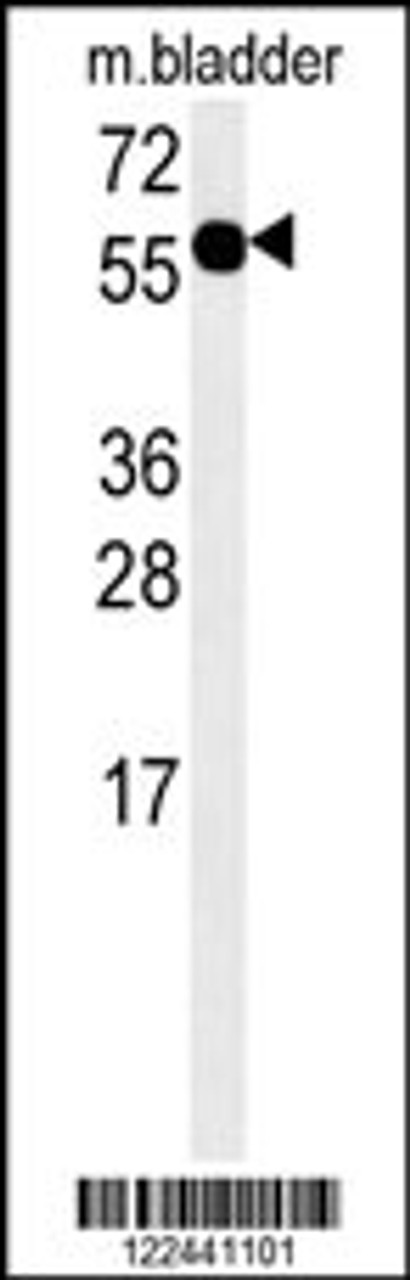 Western blot analysis in mouse bladder tissue lysates (15ug/lane) .This demonstrates the ADSSL1 antibody detected ADSSL1 protein (arrow) .