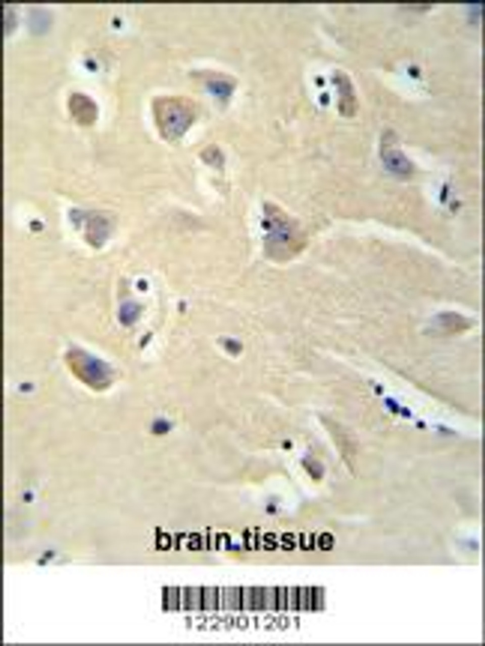 PENK antibody immunohistochemistry analysis in formalin fixed and paraffin embedded brain tissue followed by peroxidase conjugation of the secondary antibody and DAB staining.