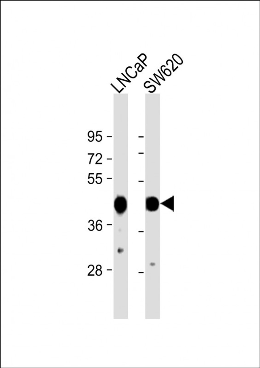 Western Blot at 1:1000 dilution Lane 1: LNCaP whole cell lysate Lane 2: SW620 whole cell lysate Lysates/proteins at 20 ug per lane.