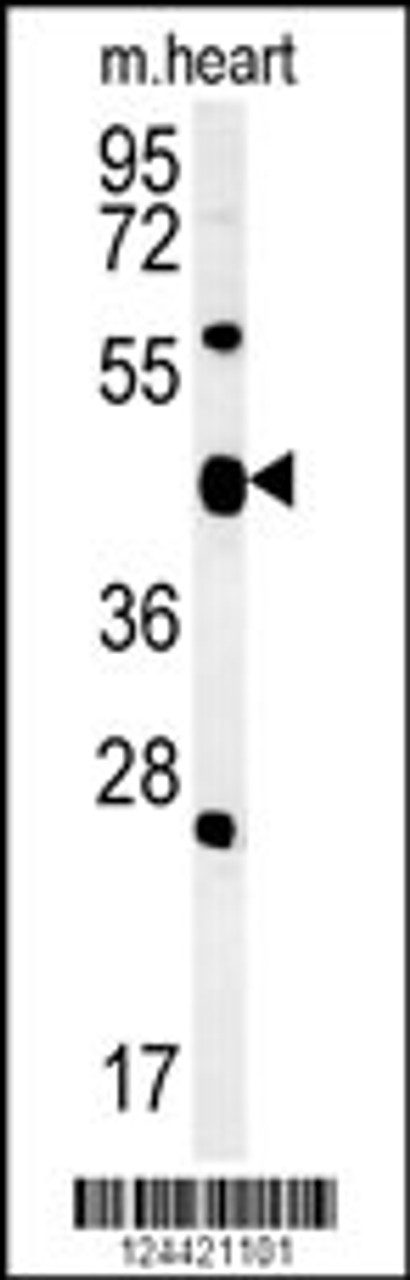 Western blot analysis in mouse heart tissue lysates (15ug/lane) .This demonstrates the detected ACSF3 protein (arrow) .