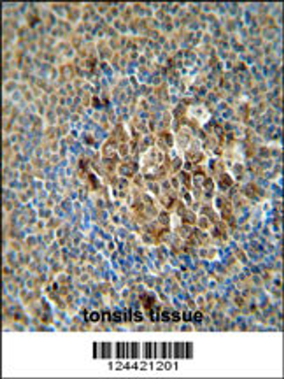 ACSF3 antibody immunohistochemistry analysis in formalin fixed and paraffin embedded human tonsils tissue followed by peroxidase conjugation of the secondary antibody and DAB staining.