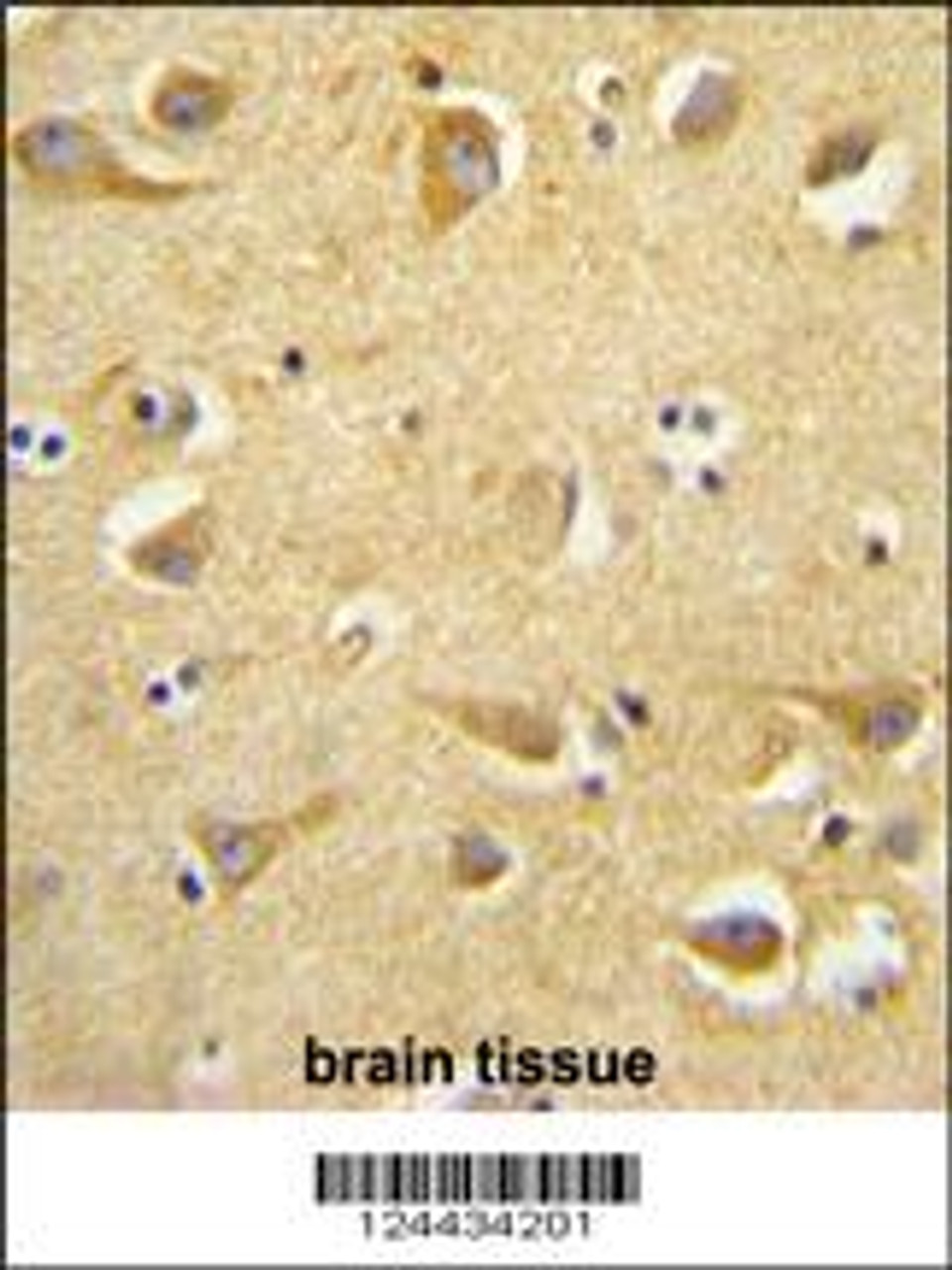 CLTC antibody immunohistochemistry analysis in formalin fixed and paraffin embedded human brain tissue followed by peroxidase conjugation of the secondary antibody and DAB staining.