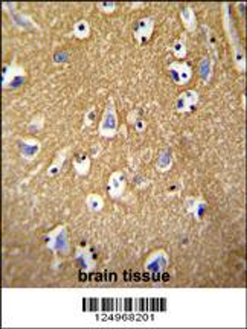BCAN antibody immunohistochemistry analysis in formalin fixed and paraffin embedded human brain tissue followed by peroxidase conjugation of the secondary antibody and DAB staining.
