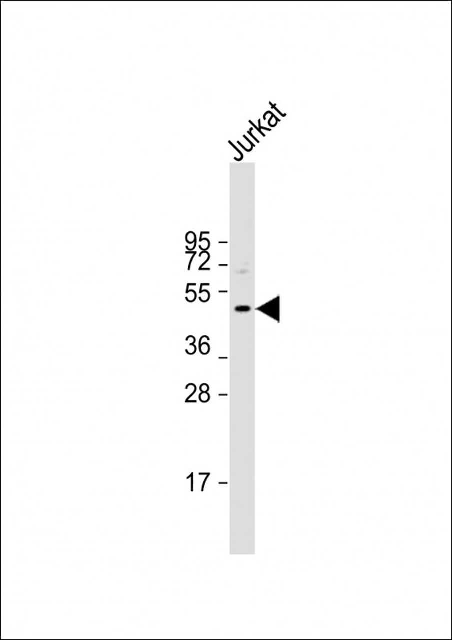 Western Blot at 1:500 dilution + Jurkat whole cell lysate Lysates/proteins at 20 ug per lane.