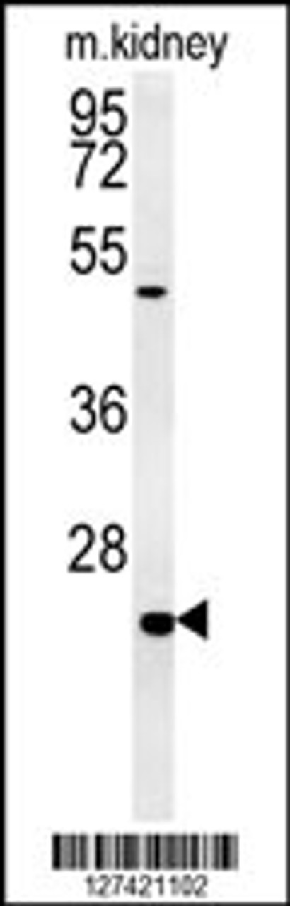 Western blot analysis in mouse kidney tissue lysates (15ug/lane) .This demonstrates the detected SHISA2 protein (arrow) .