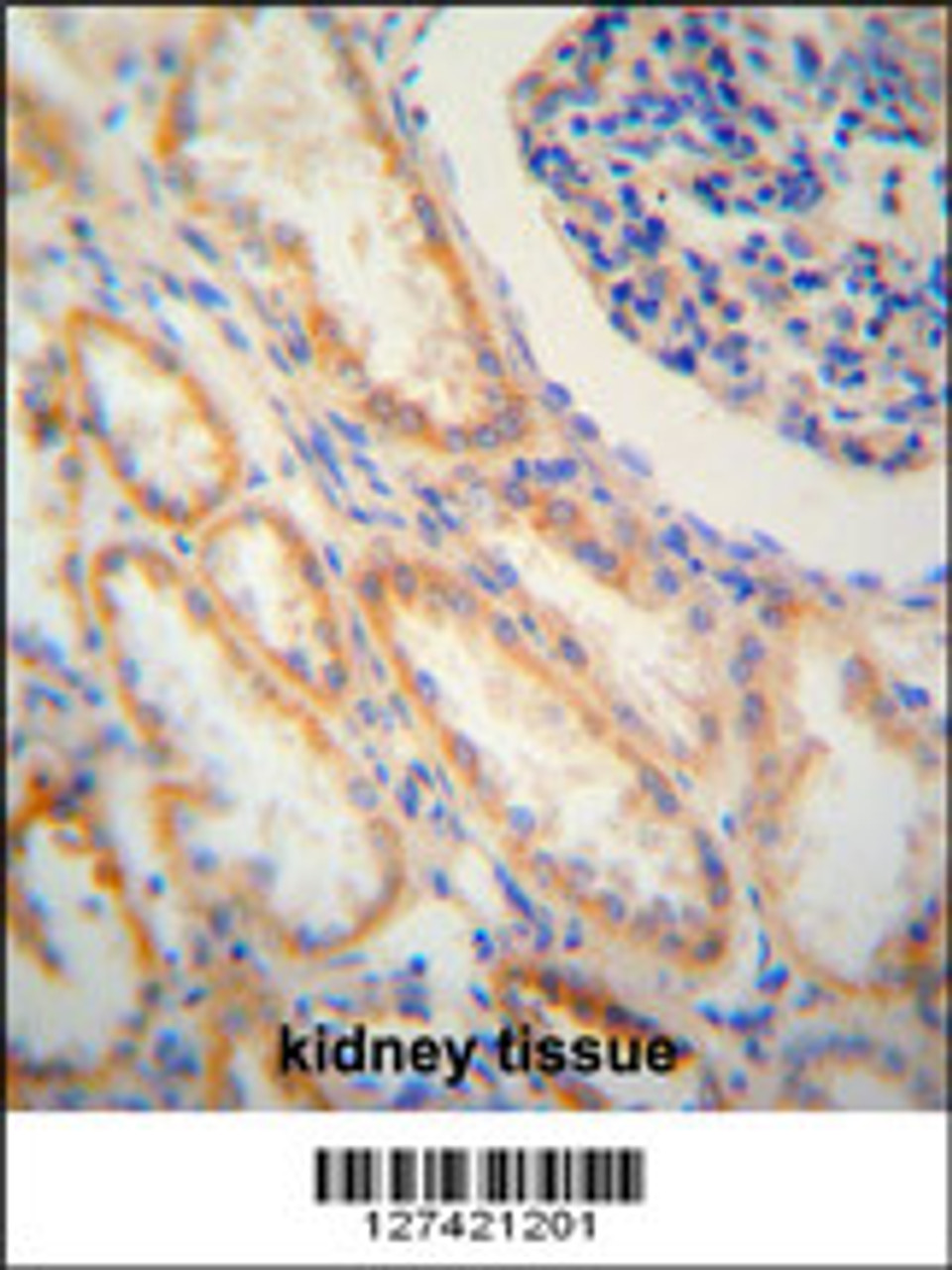 SHISA2 antibody immunohistochemistry analysis in formalin fixed and paraffin embedded human kidney tissue followed by peroxidase conjugation of the secondary antibody and DAB staining.