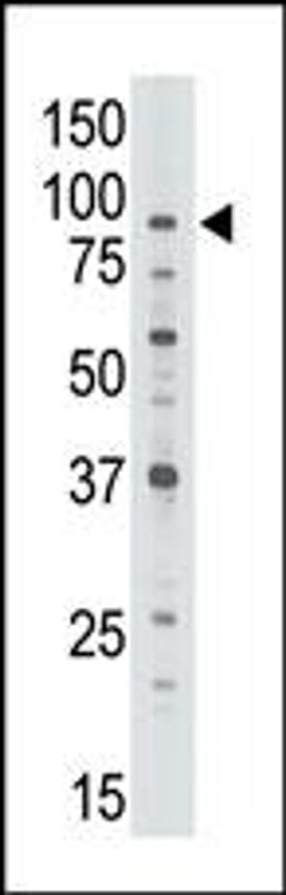 Antibody is used in Western blot to detect ABCB7 in Jurkat cell lysate.