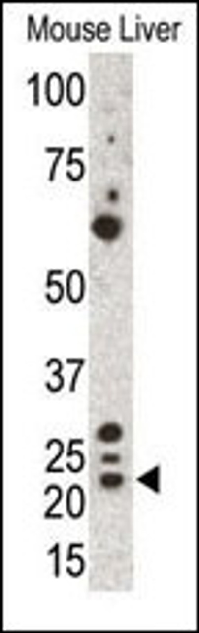 Western blot analysis of anti-Gremlin Pab in mouse liver cell lysate. Gremlin was detected by using AP6133a.