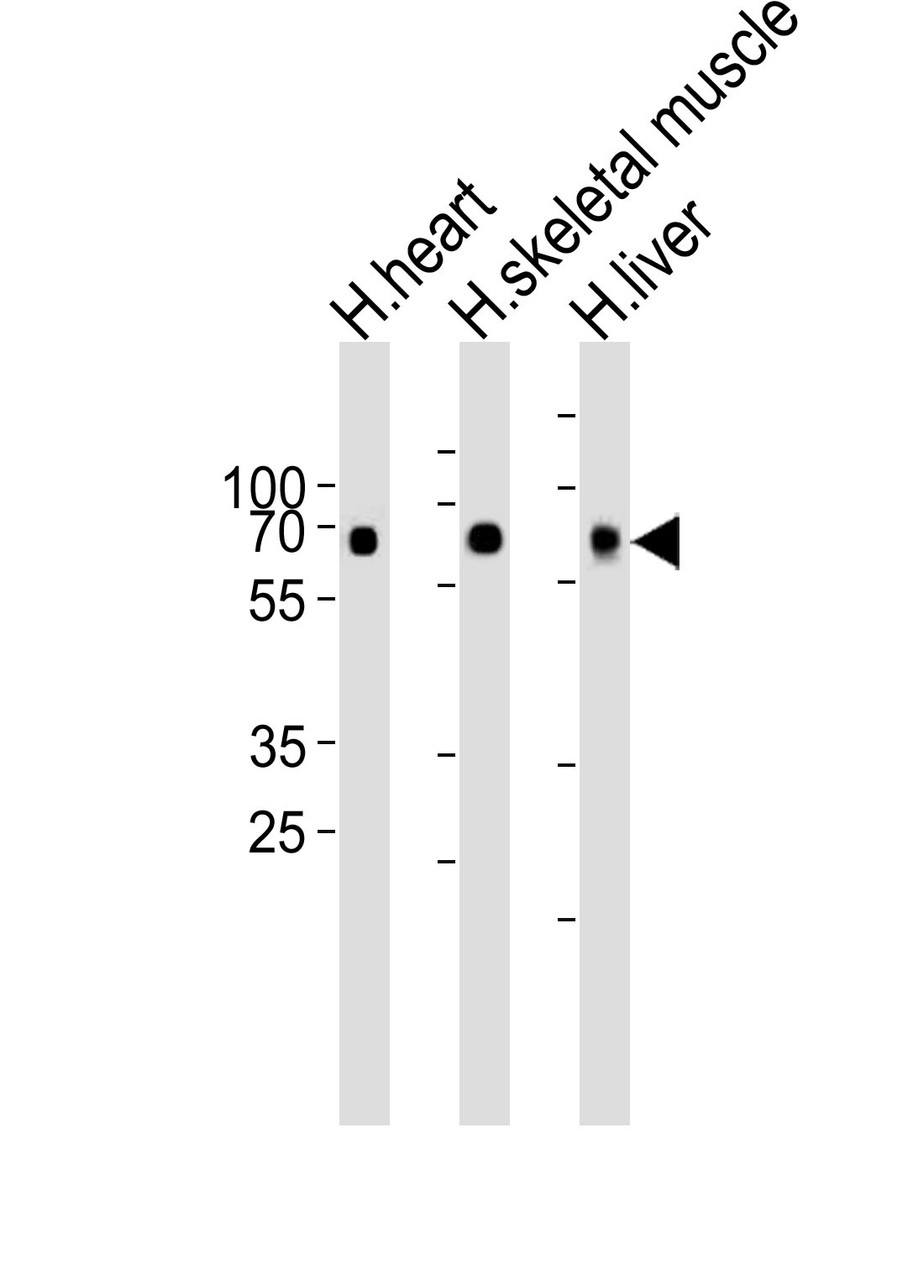 Western blot analysis of lysates from human heart, skeletal muscle and liver tissue lysate (from left to right) , using Cry2 Antibody (R579) at 1:1000 at each lane.