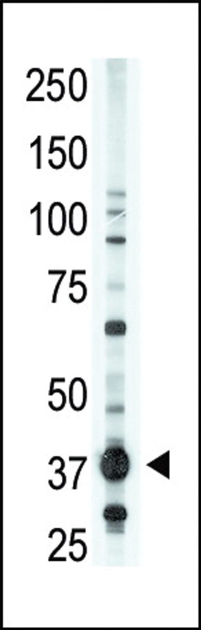 Antibody is used in Western blot to detect EDG2 in A375 lysate.