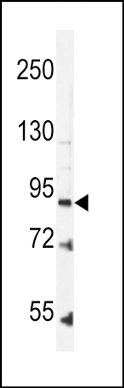 Western blot analysis in K562 cell line lysates (35ug/lane) .This demonstrates the LEPR antibody detected the LEPR protein (arrow) .