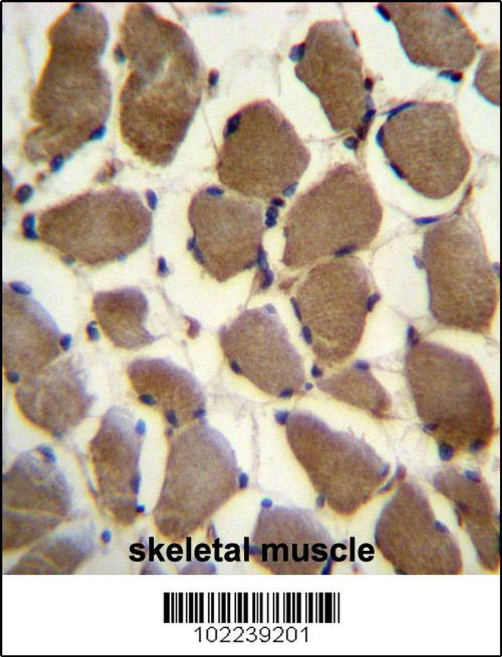 LRP3 Antibody immunohistochemistry analysis in formalin fixed and paraffin embedded human skeletal muscle followed by peroxidase conjugation of the secondary antibody and DAB staining.
