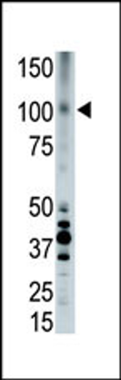 Antibody is used in Western blot to detect LRP8 in placenta cell lysate.