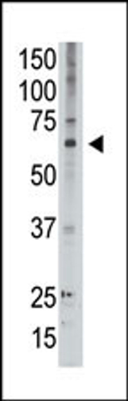 Antibody is used in Western blot to detect MAGED2 in A549 lysate.
