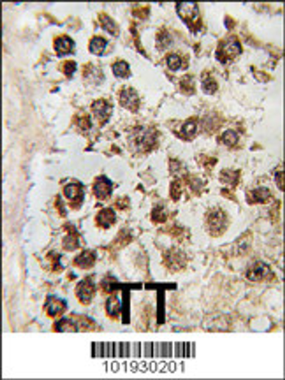 Formalin-fixed and paraffin-embedded human testis tissue reacted with MLLT10 antibody, which was peroxidase-conjugated to the secondary antibody, followed by DAB staining.