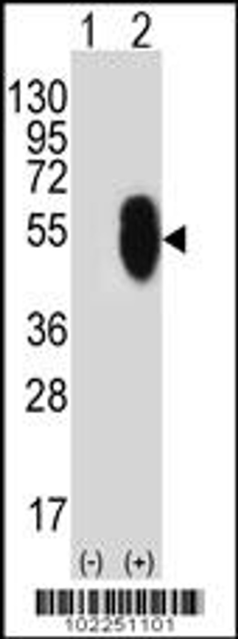 Western blot analysis of MLLT6 using rabbit polyclonal MLLT6 Antibody (E1071) using 293 cell lysates (2 ug/lane) either nontransfected (Lane 1) or transiently transfected (Lane 2) with the MLLT6 gene.