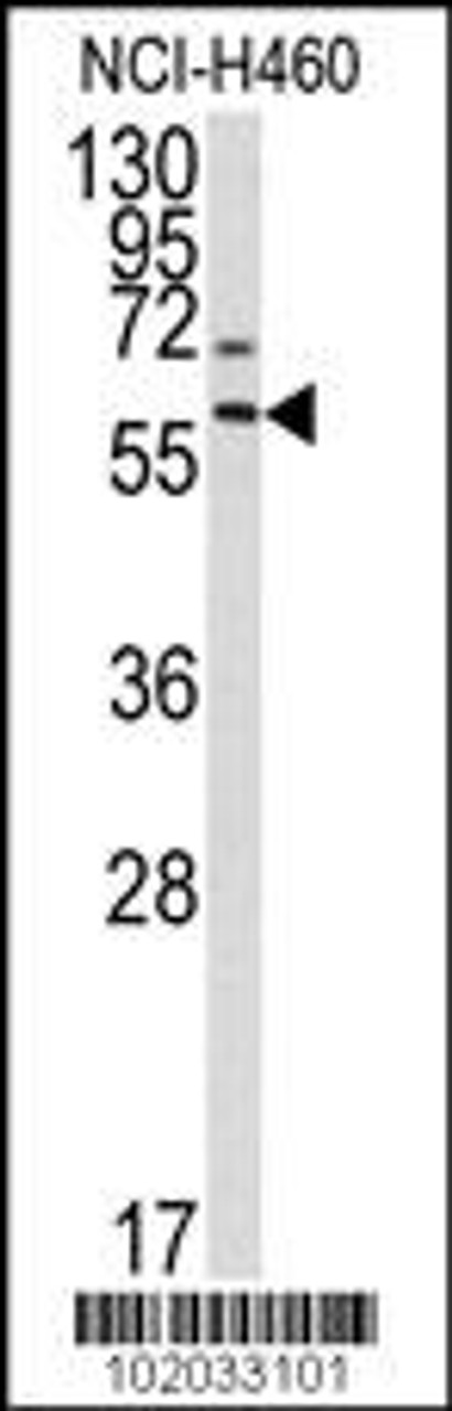 Western blot analysis of anti-MMP17 Antibody in NCI-H460 cell line lysates (35ug/lane) .