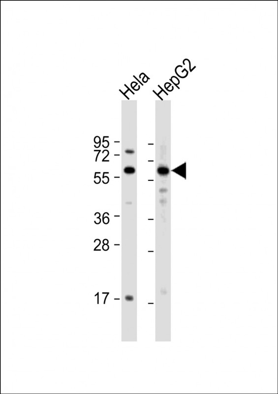 Western Blot at 1:1000 dilution Lane 1: Hela whole cell lysate Lane 2: HepG2 whole cell lysate Lysates/proteins at 20 ug per lane.