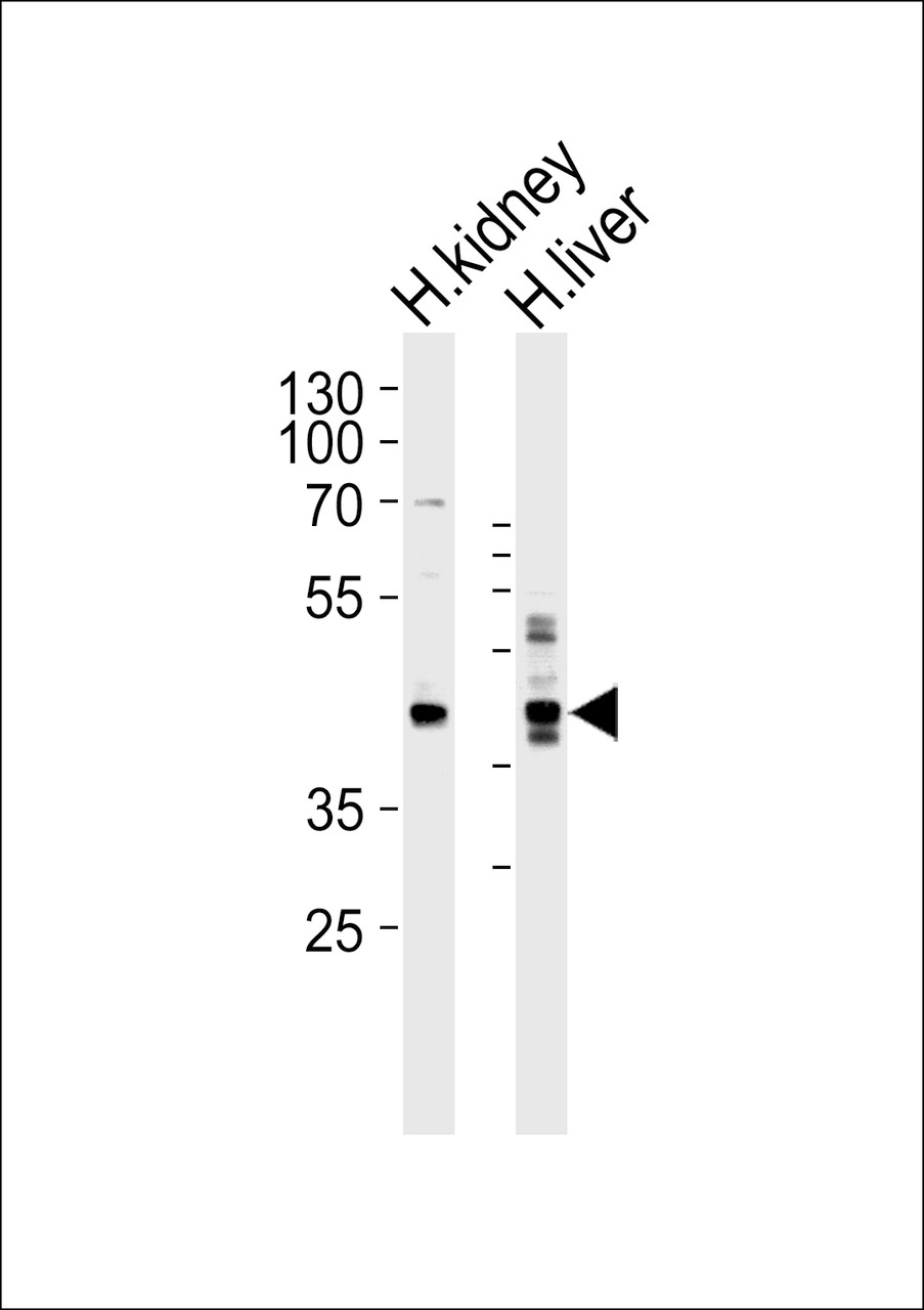 Western blot analysis of lysates from human kidney and liver tissue lysate (from left to right) , using SEPT9 Antibody at 1:1000 at each lane.