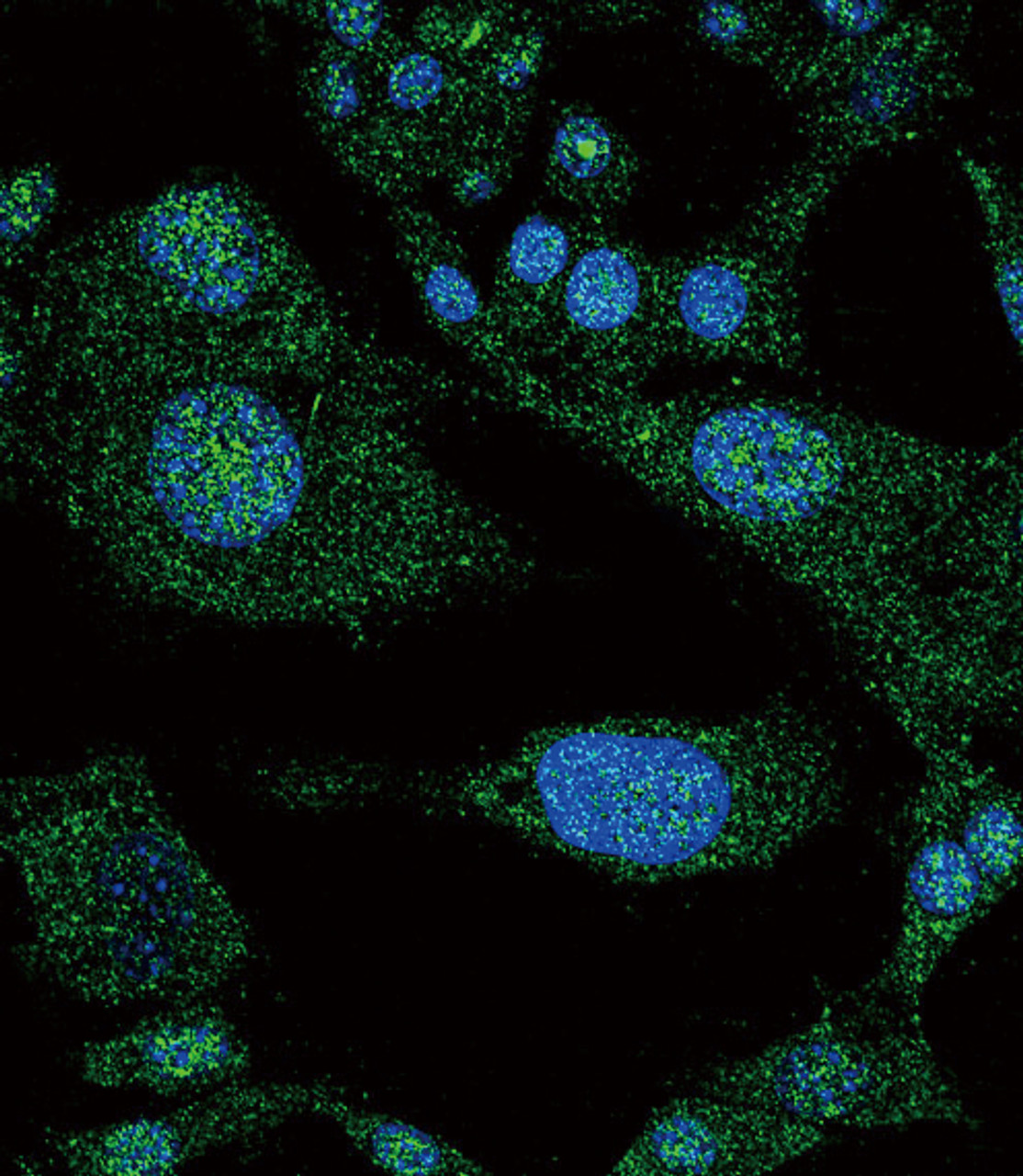 Confocal immunofluorescent analysis of NOTCH3 Antibody with HepG2 cell followed by Alexa Fluor 488-conjugated goat anti-rabbit lgG (green) . DAPI was used to stain the cell nuclear (blue) .