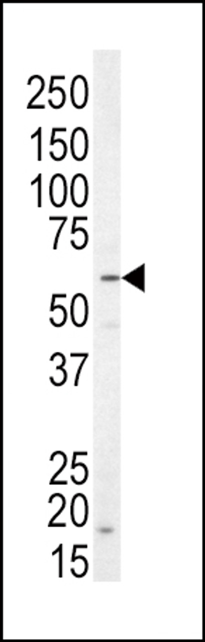 Western blot analysis of anti-NRG1 Antibody in SK-BR-3 cell line lysates (35ug/lane)