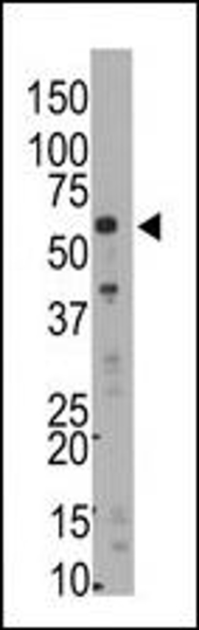 Antibody is used in Western blot to detect Rai15 in mouse liver tissue lysate.