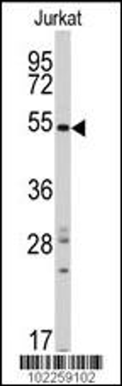 Western blot analysis of anti-RAI15 Antibody ( in Jurkat cell line lysates (35ug/lane) .