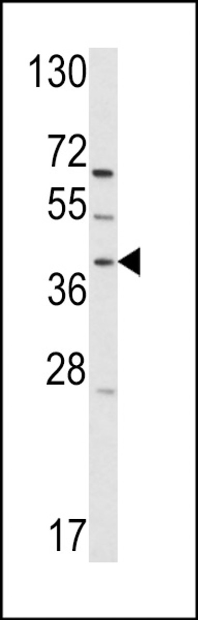 Western blot analysis of hRai3-W343 in T47D cell line lysates (35ug/lane)