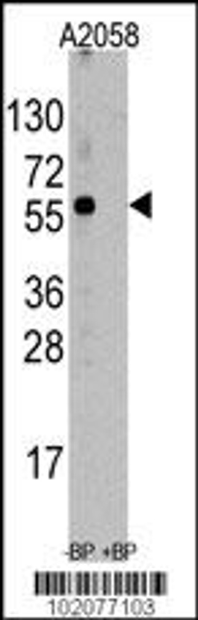 Western blot analysis of anti-ST13 Antibody pre-incubated with and without blocking peptide (BP6247a) in A2058 cell line lysate.