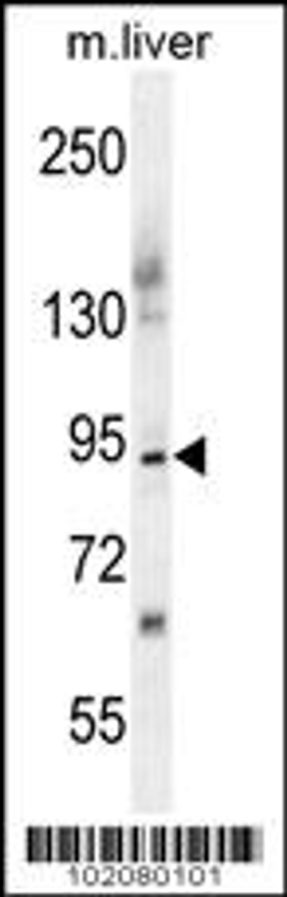 Western blot analysis in mouse liver tissue lysates (35ug/lane) .This demonstrates the ST14 antibody detected the ST14 protein (arrow) .