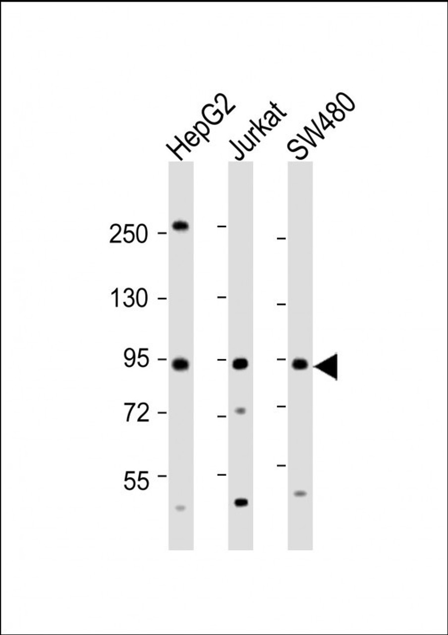 Western Blot at 1:2000 dilution Lane 1: HepG2 whole cell lysate Lane 2: Jurkat whole cell lysate Lane 3: SW480 whole cell lysate Lysates/proteins at 20 ug per lane.