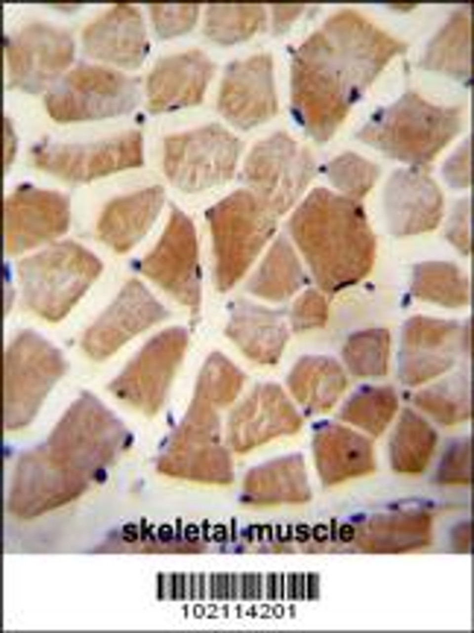 WISP2 Antibody immunohistochemistry analysis in formalin fixed and paraffin embedded human skeletal muscle followed by peroxidase conjugation of the secondary antibody and DAB staining.