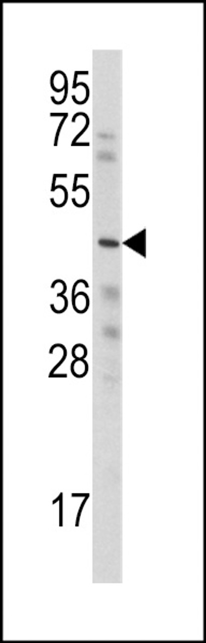 Western blot analysis of anti-WISP3 Antibody in HepG2 cell line lysates (35ug/lane)