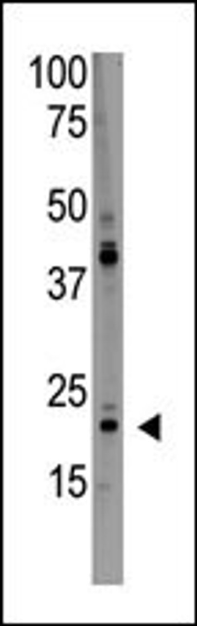 Antibody is used in Western blot to detect PDAP1 in HL60 lysate.