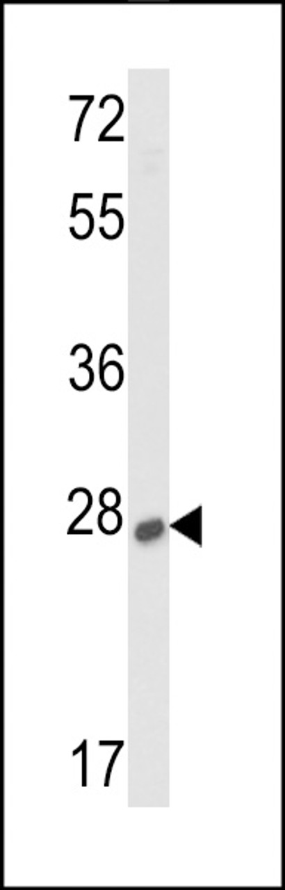 Western blot analysis of lysates from human kidney and liver tissue lysates (from left to right) , using SOST Antibody at 1:1000 at each lane.