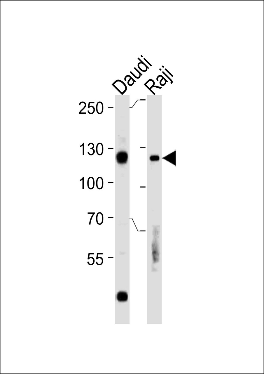 Western blot analysis in Daudi, Raji cell line lysates (35ug/lane) .This demonstratdetected the Rb protein (arrow) .