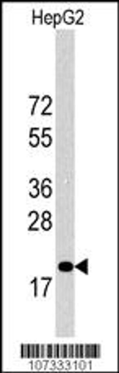 Western Blot in HepG2 cell line lysates (35ug/lane) . 27Kip1 (arrow) was detected using the purified Pab.