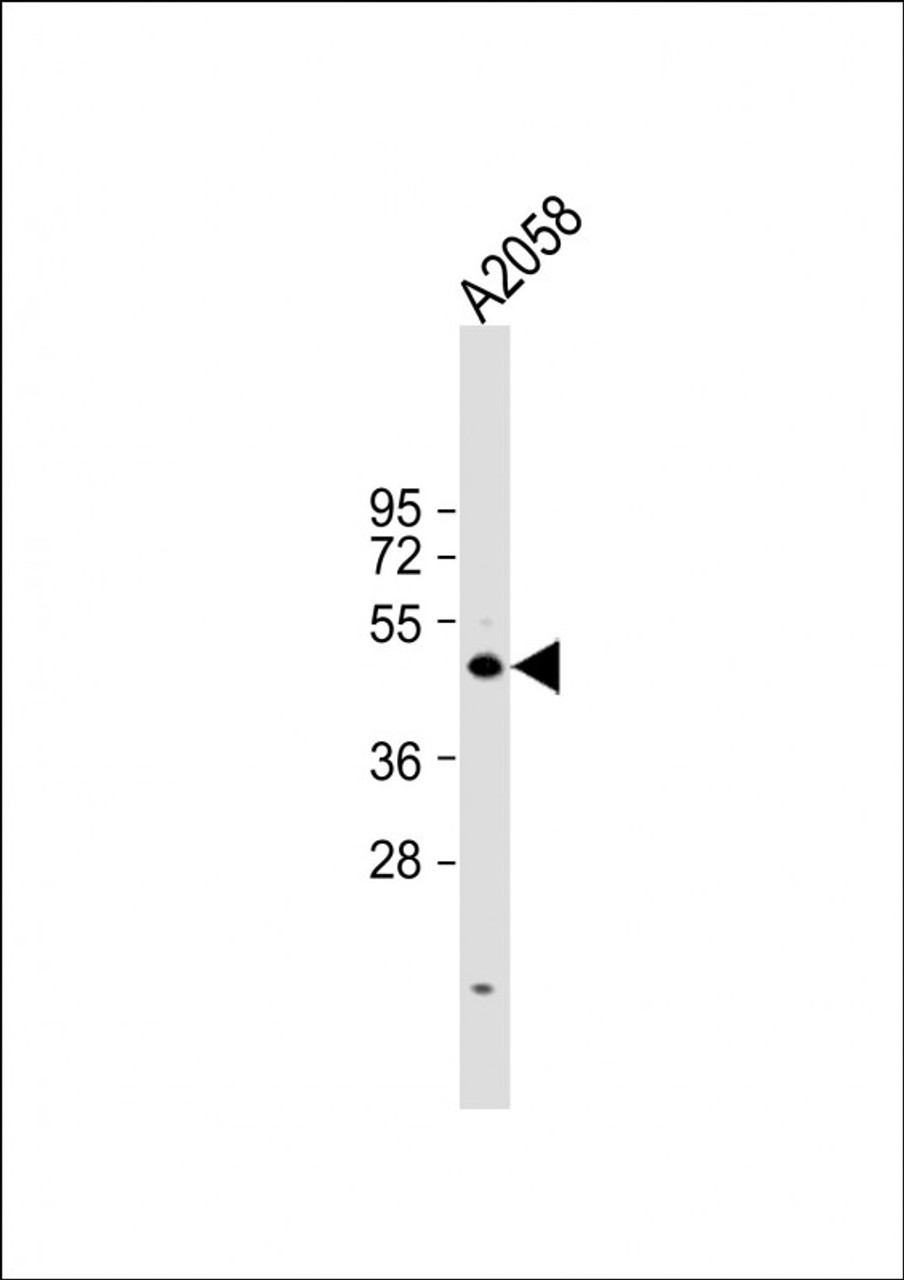 Western Blot at 1:1000 dilution + A2058 whole cell lysate Lysates/proteins at 20 ug per lane.