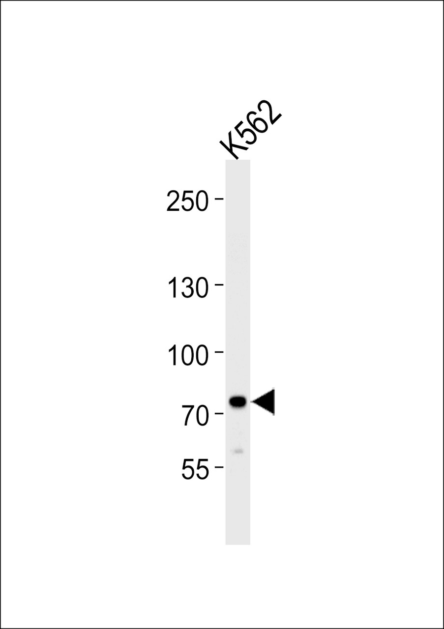 Western blot analysis of lysate from K562 cell line, using SOX30 Antibody at 1:1000 at each lane.