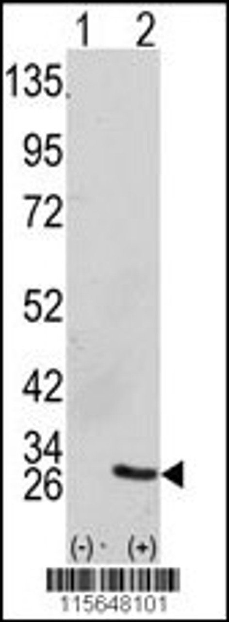 Western blot analysis of GRB2 using GRB2 Antibody using 293 cell lysates (2 ug/lane) either nontransfected (Lane 1) or transiently transfected with the GRB2 gene (Lane 2) .