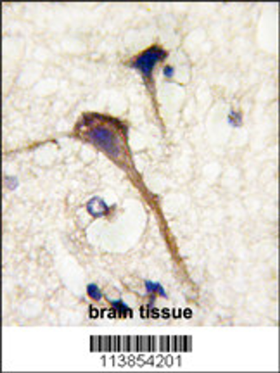 Formalin-fixed and paraffin-embedded human brain tissue reacted with INA antibody, which was peroxidase-conjugated to the secondary antibody, followed by DAB staining.
