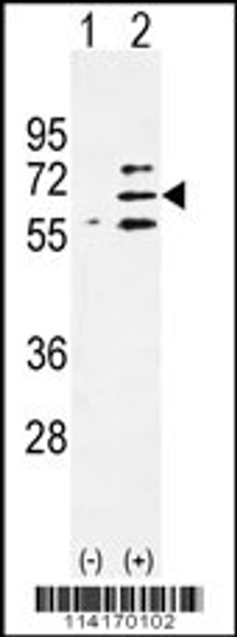 Western blot analysis of Parp6 using rabbit polyclonal Parp6 Antibody using 293 cell lysates (2 ug/lane) either nontransfected (Lane 1) or transiently transfected (Lane 2) with the Parp6 gene.