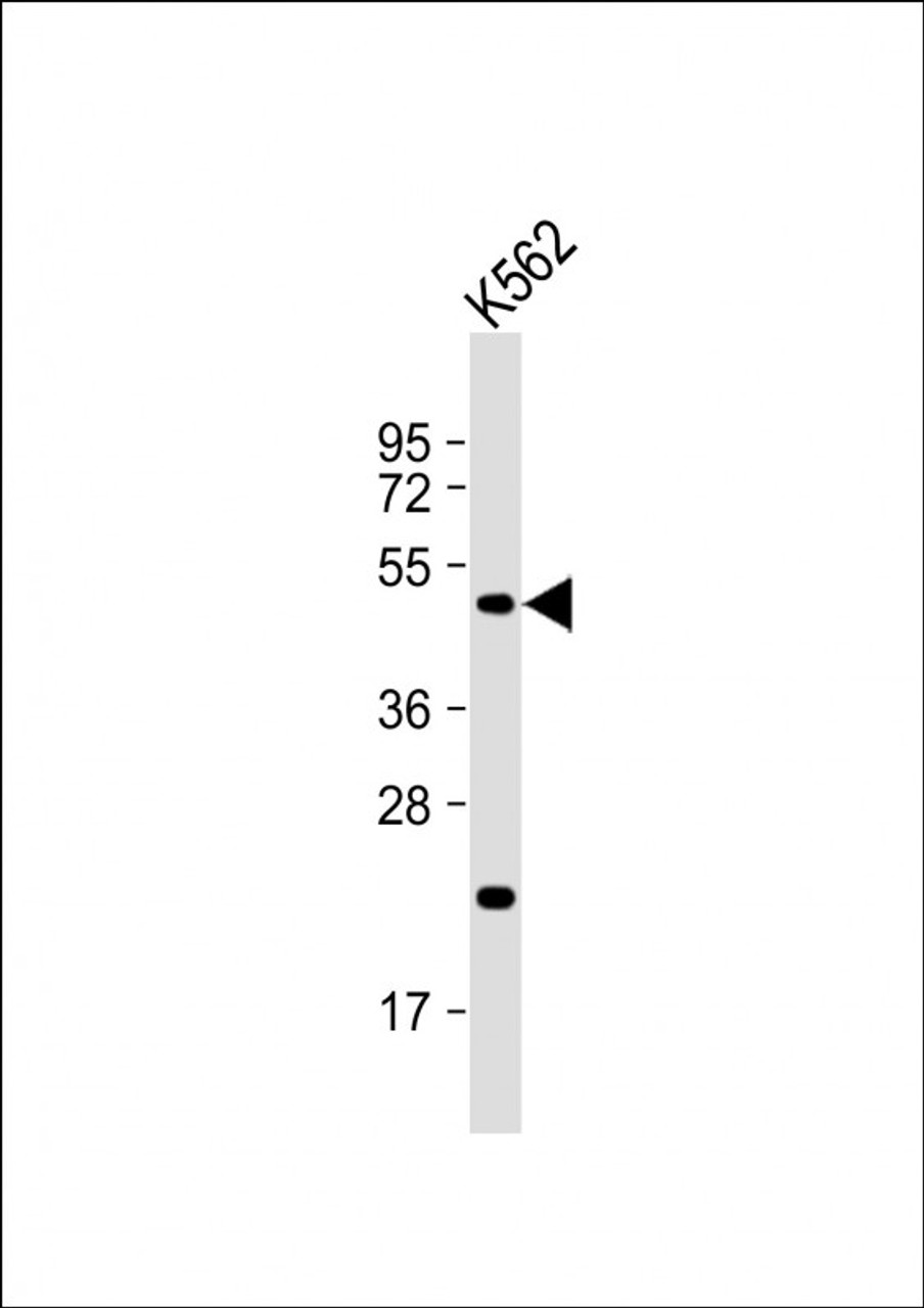 Western Blot at 1:1000 dilution + K562 whole cell lysate Lysates/proteins at 20 ug per lane.